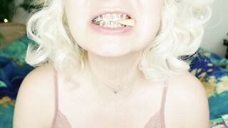 BRACES fetish: ASMR video of eating MUKBANG.