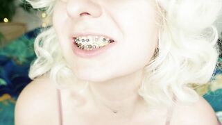 BRACES fetish: ASMR video of eating MUKBANG.