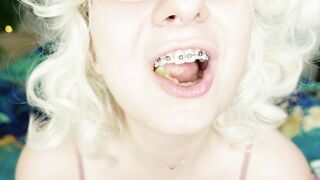 BRACES fetish: ASMR video of eating MUKBANG.