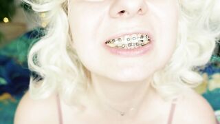 BRACES fetish: ASMR video of eating MUKBANG.