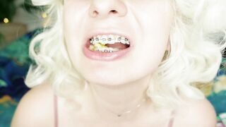 BRACES fetish: ASMR video of eating MUKBANG.