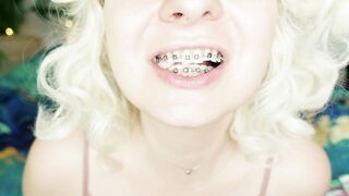 BRACES fetish: ASMR video of eating MUKBANG.