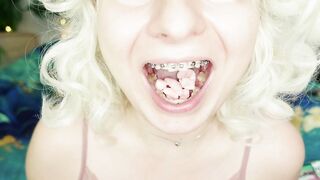 BRACES fetish: ASMR video of eating MUKBANG.